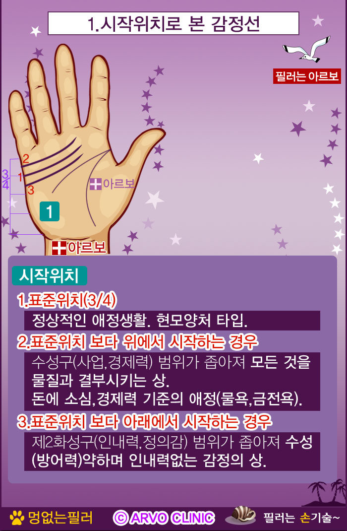 감정선,감정선시작부위,아르보의원